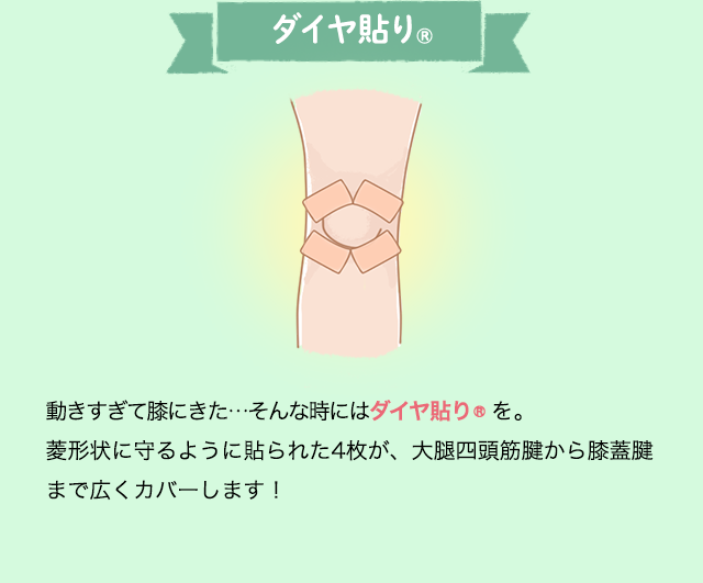 ダイヤ貼り® 動きすぎて膝にきた。そんな時にはダイヤ貼り®を。菱形状に守るように貼られた4枚が、大腿四頭筋腱から膝蓋腱まで広くカバーします！